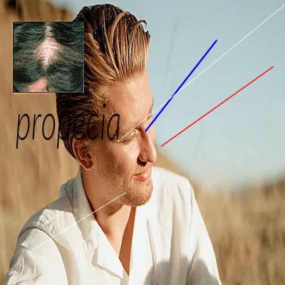 Prix propecia finasteride